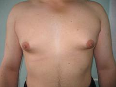 gyno.jpg