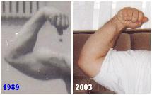 Предплечья_1989___2003.JPG