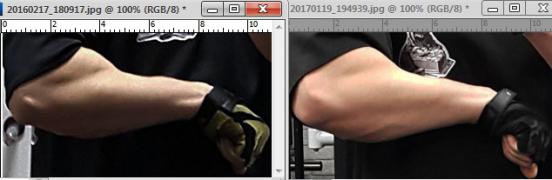 2016-2017 Предплечье.jpg