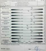 Импендансометрия (Октябрь 2019) ЛОДЭ 1.jpg