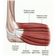 TENNIS ELBOW⠀ANATOMY, PATHOLOGY AND SELF-TREATMENT⠀Tennis elbow is a problem with the tendons that attach the bony bump at the outer side of your elbow with the muscles in your forearm and wrist.⠀Tendons can be injured suddenly  (1).jpg