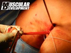 jay-surgery2.jpg
