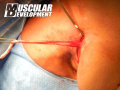 jay-surgery3.jpg