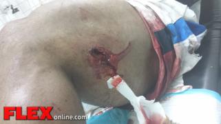 roelly_injury_2-17-14-4.jpg