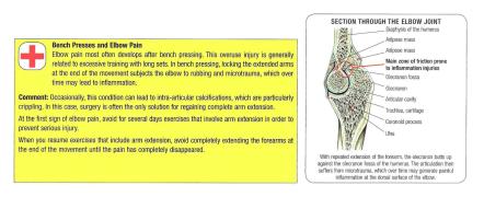 Bench_press_lockouts_pain_p54.jpg