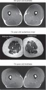 Muscle-mass-age-and-exercise-MRI.jpeg