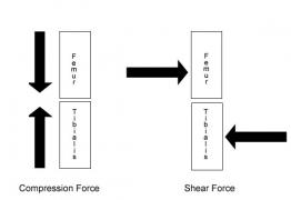 compression-and-shear-stress-knee1.jpg