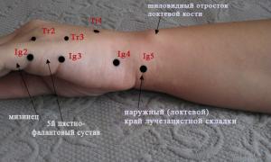Шиловидный отросток локтевой кости.jpg