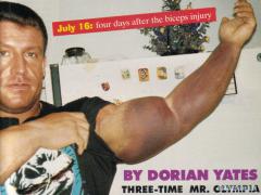 Dorians_Yates_4_дня_после_травмы_бицепса.jpg