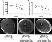 sarcopenia.jpg