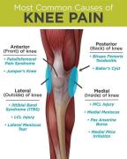 stopkneepain_1715185146149.jpeg