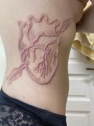 Scarification_my-seven-months-heart-scarification_001.jpg
