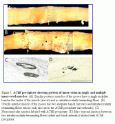 Model_of_skeletal_muscle_hypertrophy_01.gif
