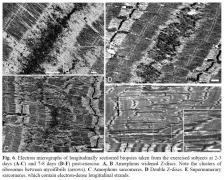 Amorphous sarcomeres.jpg