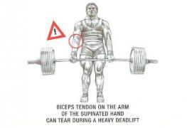 Biceps_Tear_By_Deadlift.jpg
