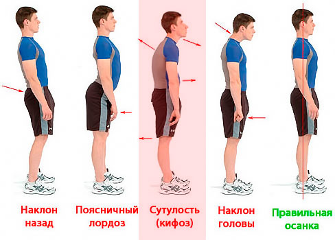 Как выпрямить шею