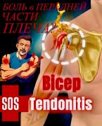 Боль в передней части плеча Возможно, сухожилие бицепса перегружено ????Если жим, тяга или сгибани.jpg