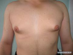 gyno.jpg