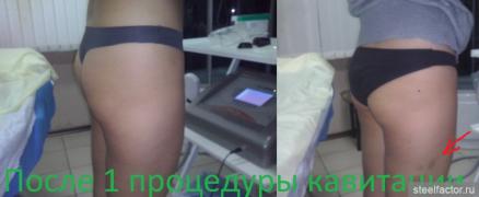 бедра ани.jpg