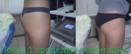 бедра ани.jpg