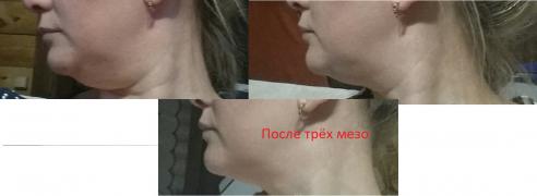 итоги 1.jpg