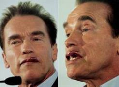 Arnold-Schwarzenegger-Facial-Plastic-Surgery-1.jpg