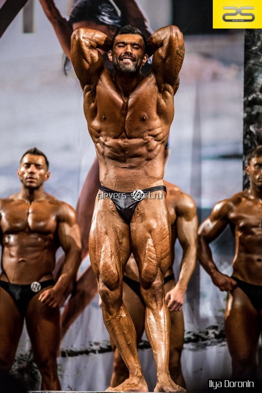 Отек ног на курсе стероидов